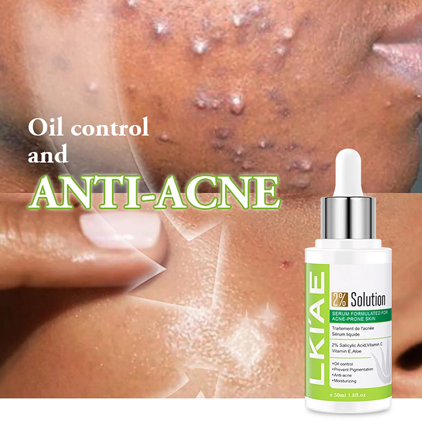 LKIAE Aloe Vera Lightening Face Serum, Idea Facial Essence to Anti Acne, with Vitamin C, Vitamin E, Moisturizing, Clean Skin