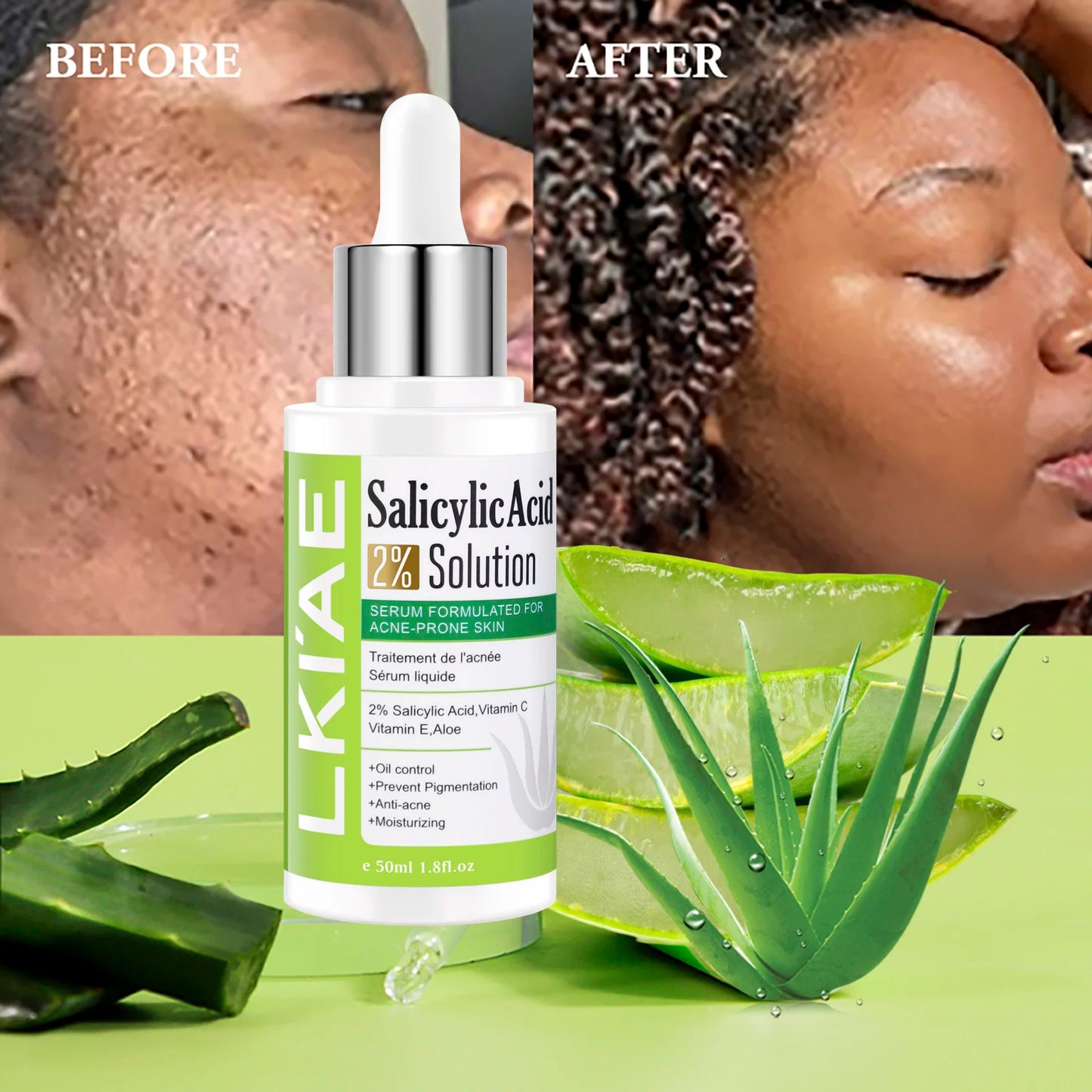 LKIAE Aloe Vera Lightening Face Serum, Idea Facial Essence to Anti Acne, with Vitamin C, Vitamin E, Moisturizing, Clean Skin